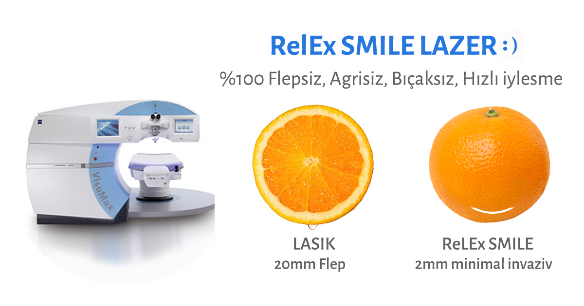 Коррекция smile clinicaspectr ru. Лазерная коррекция RELEX smile. Smile технология лазерной коррекции зрения. Метод лазерной коррекции RELEX smile. Лазерная коррекция зрения методом Femto-LASIK.